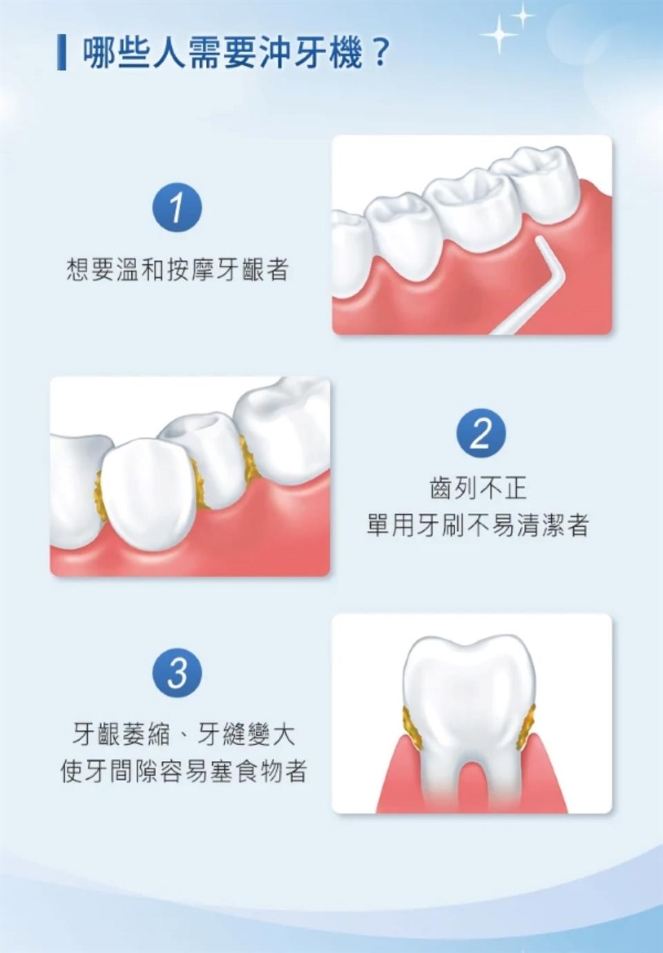 使牙間隙容易塞食物者