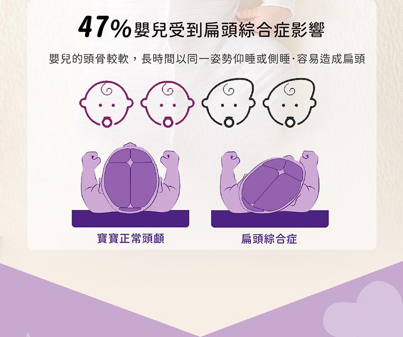 47%嬰兒受到扁頭綜合症影響 嬰兒的頭骨較軟,長時間以同一姿勢仰睡或側睡容易造成扁頭 寶寶正常頭顱 扁頭綜合症 