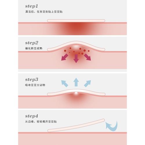 韓國正品隱形可上妝痘痘貼