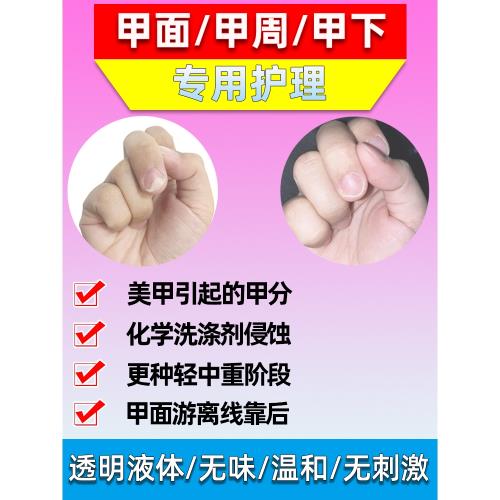 云格森甲床分離增厚粉化修復液