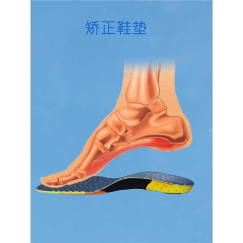 矯正鞋墊高足弓足內翻O型腿扁平足足外翻X型腿足底筋膜損傷足底痛
