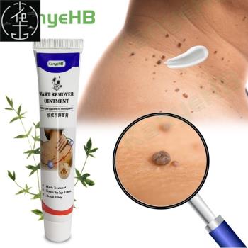 2Warts Remover Ointment Wart Treatment Cream Skin Tag Remove