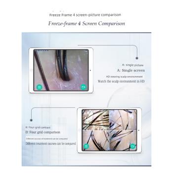 無線WIFI頭皮頭發毛囊檢測儀皮膚毛發測試儀器理發店高清放大器