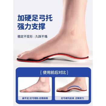 成人加硬扁平足矯正鞋墊足弓塌陷平底足糾正足外翻腳踝內歪支撐墊