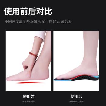 (免運)重度扁平足矯正鞋墊足弓墊成人支撐足改善xo腿型直腿神器小腿外翻