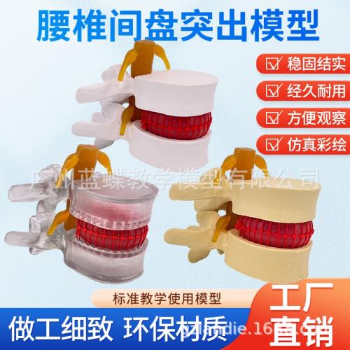 腰椎　模型 教學仿真人體腰椎間盤演示突出模型脊柱測壓演示脊椎壓力病變脊椎|教具