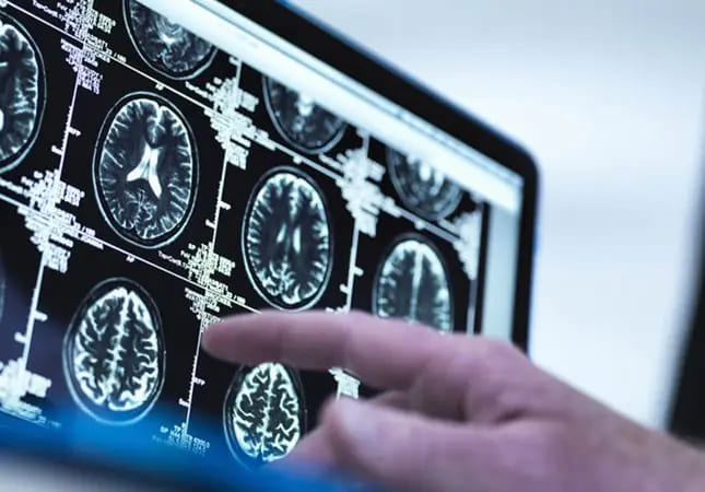 常常腦霧？最新研究揭「大腦要洗澡」　醫：運動防失智